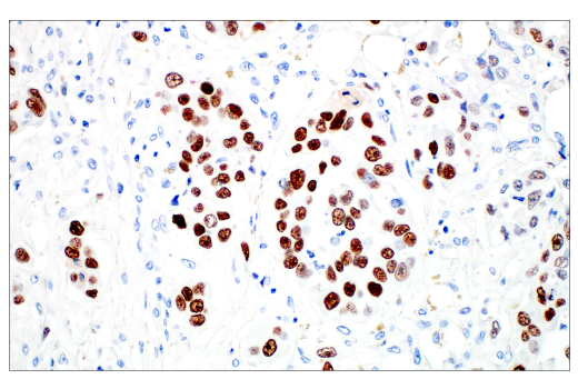 Immunohistochemistry Image 4: MAGE-C2/CT10 (E7B8D) XP® Rabbit mAb (BSA and Azide Free)