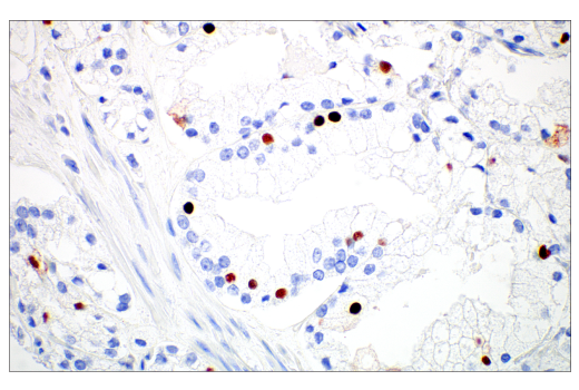 Immunohistochemistry Image 3: MAGE-C2/CT10 (E7B8D) XP® Rabbit mAb (BSA and Azide Free)