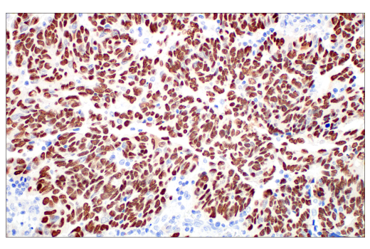 Immunohistochemistry Image 1: MAGE-C2/CT10 (E7B8D) XP® Rabbit mAb (BSA and Azide Free)