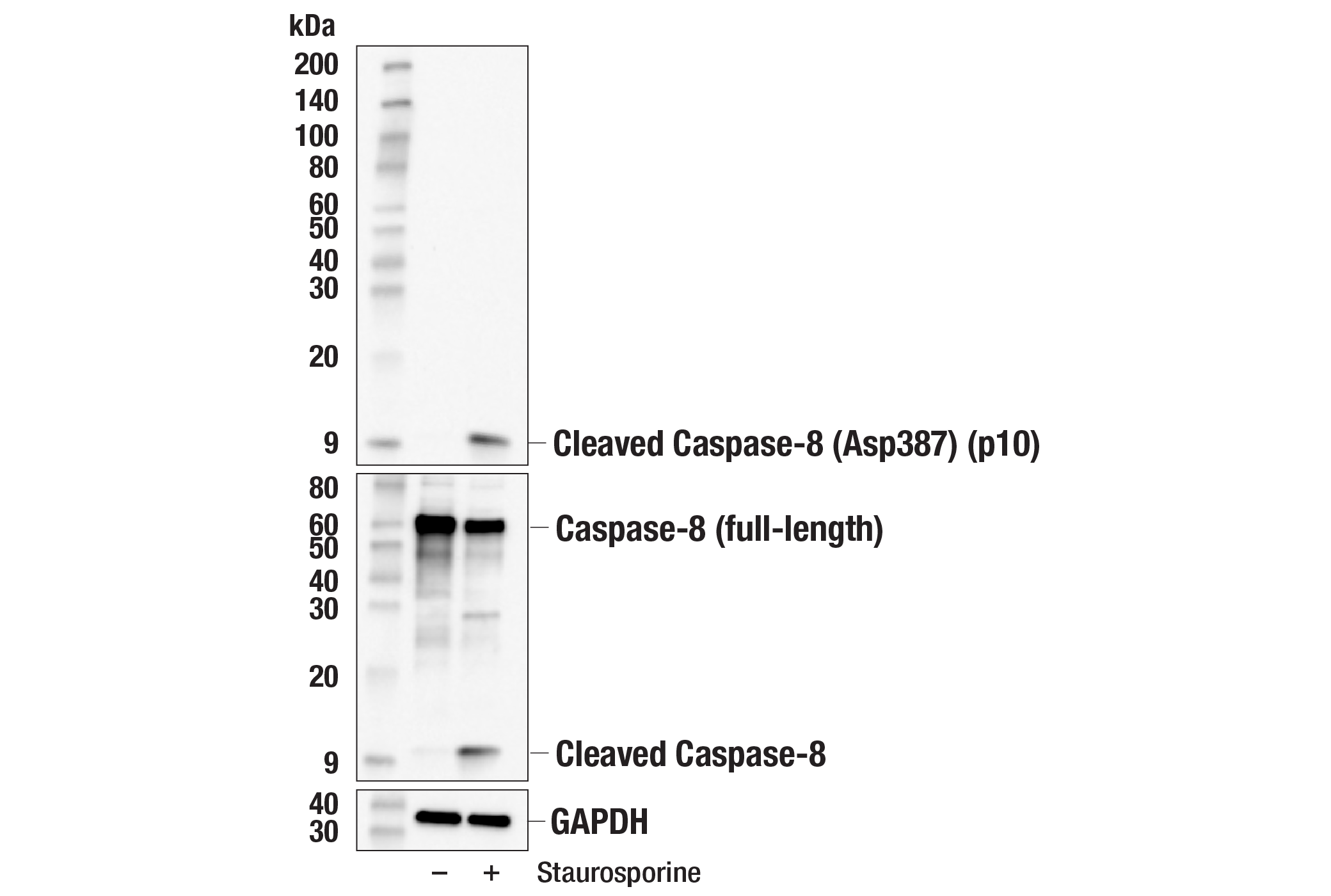 Western Blotting Image 2: Cleaved Caspase-8 (Asp387) (p10 subunit) (E8K5S) Rabbit mAb