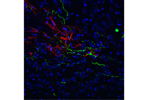 Immunofluorescence Image 1: Orexin (D6G9T) Rabbit mAb