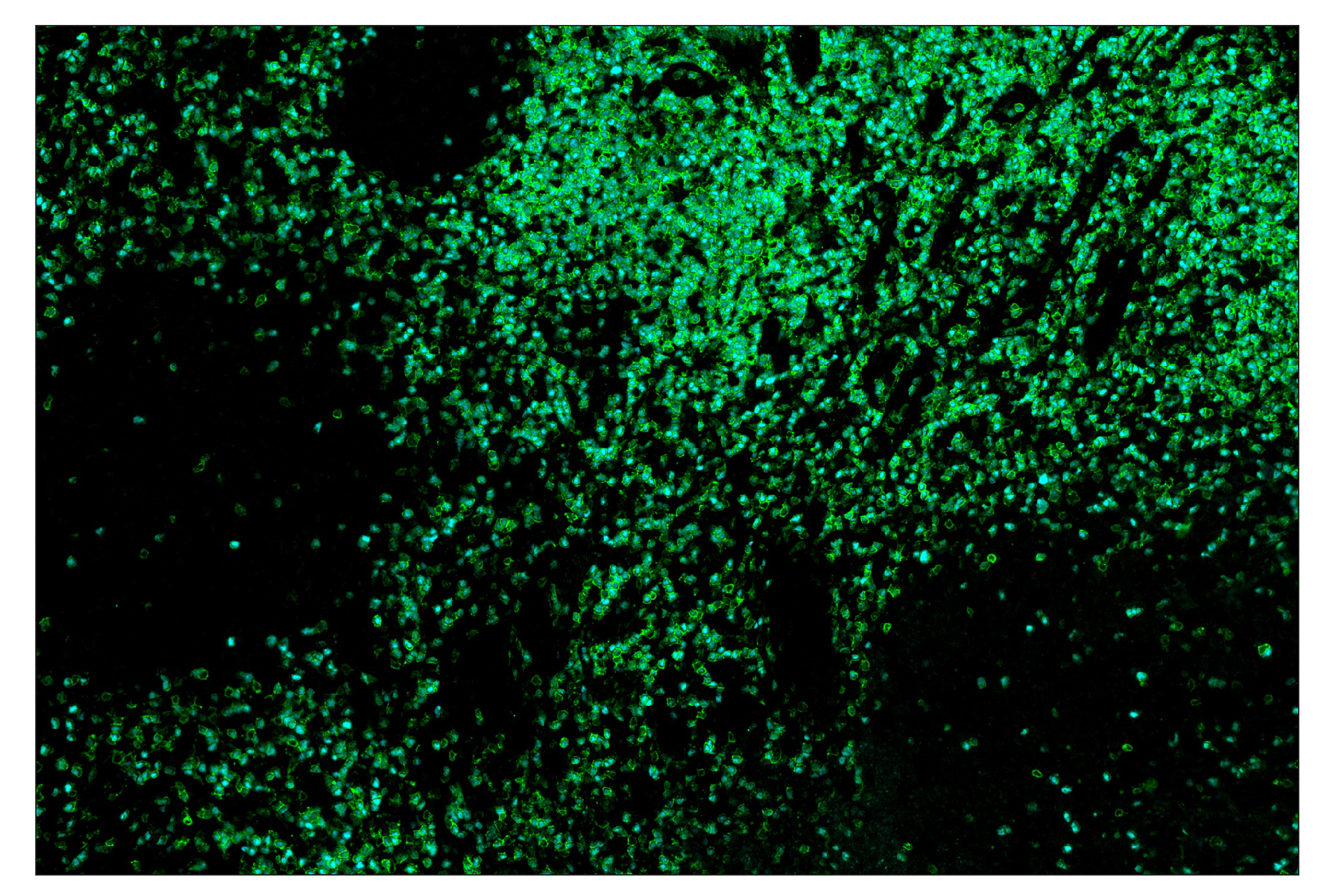 Immunohistochemistry Image 9: TCF1/TCF7 (C63D9) & CO-0006-594 SignalStar™ Oligo-Antibody Pair