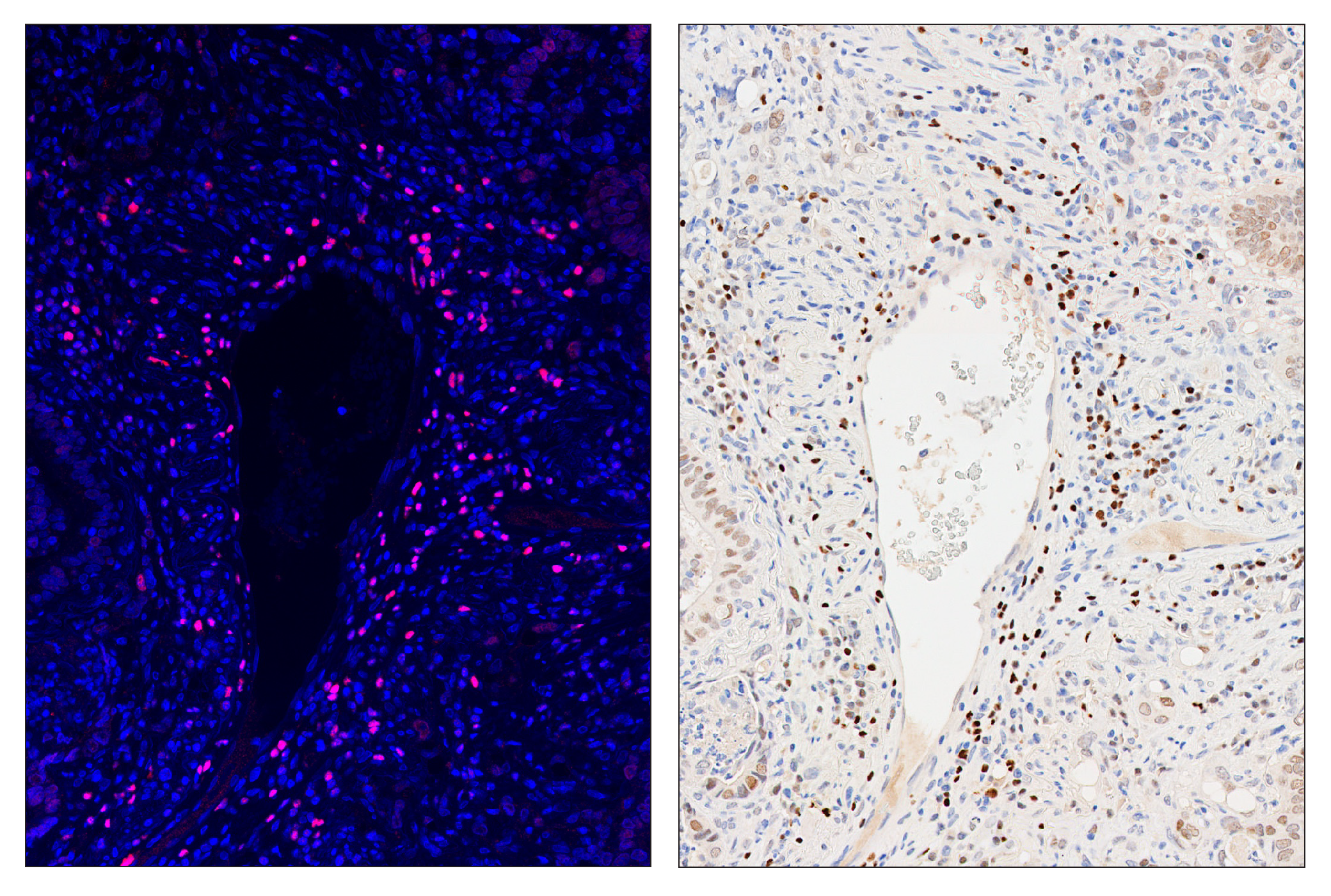Immunohistochemistry Image 6: TCF1/TCF7 (C63D9) & CO-0006-647 SignalStar™ Oligo-Antibody Pair