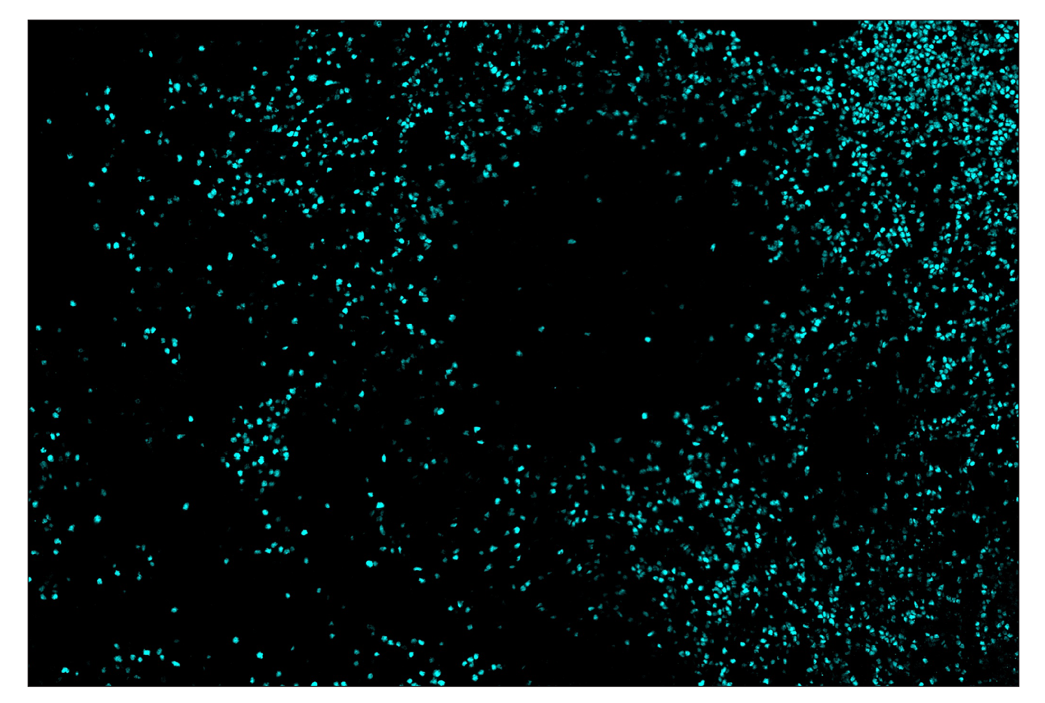 Immunohistochemistry Image 5: TCF1/TCF7 (C63D9) & CO-0006-594 SignalStar™ Oligo-Antibody Pair