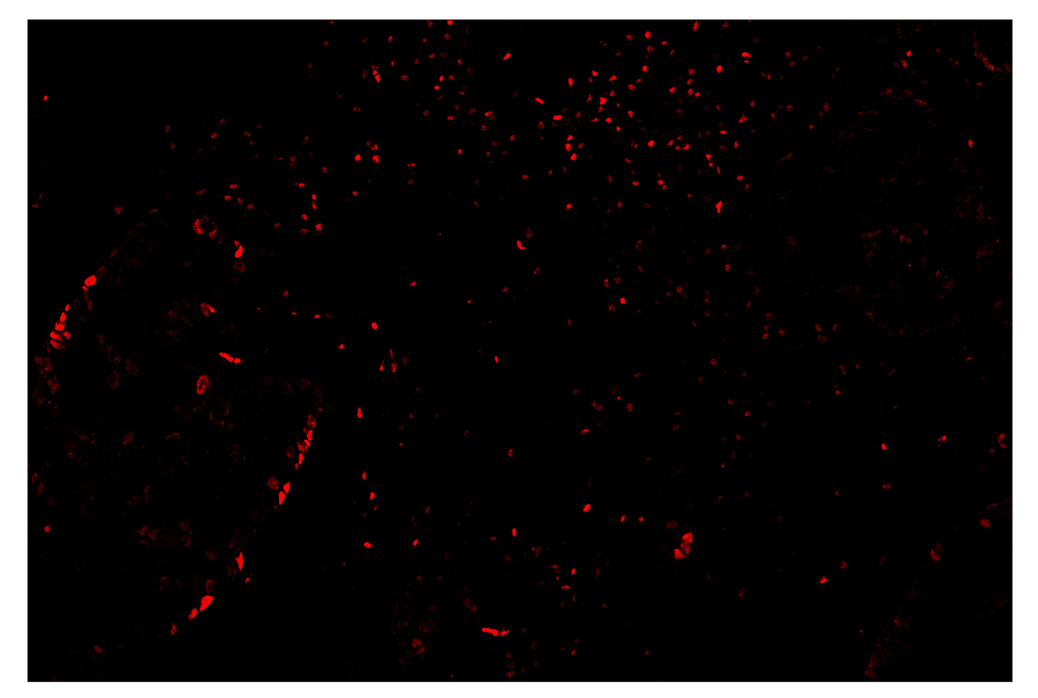 Immunohistochemistry Image 4: TCF1/TCF7 (C63D9) & CO-0006-488 SignalStar™ Oligo-Antibody Pair