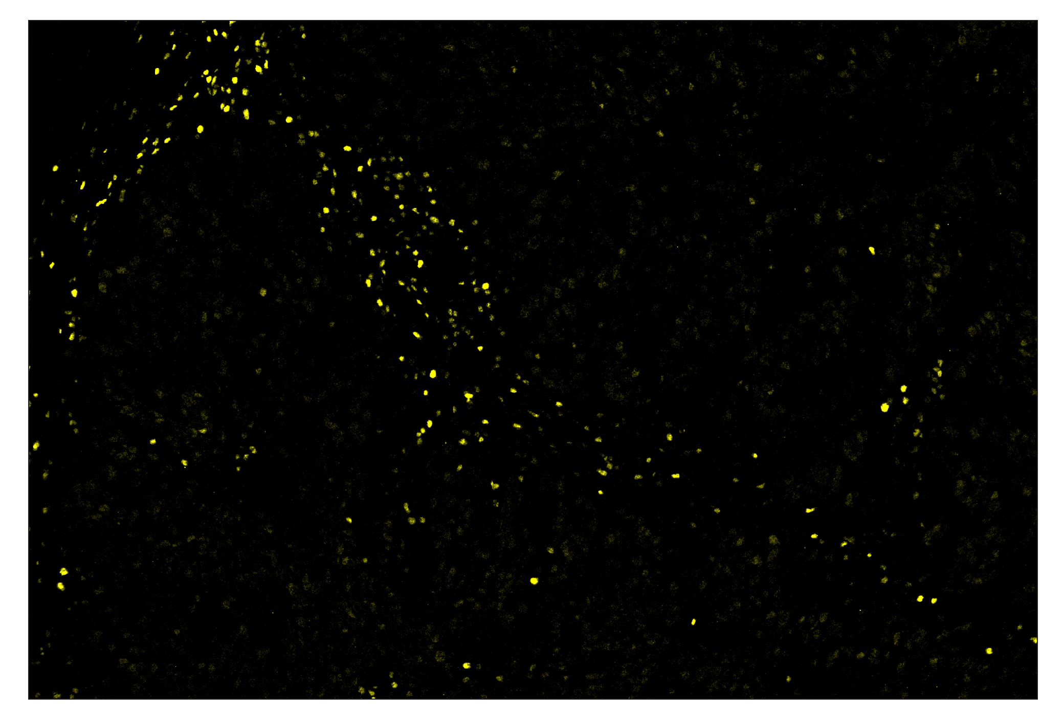Immunohistochemistry Image 3: TCF1/TCF7 (C63D9) & CO-0006-594 SignalStar™ Oligo-Antibody Pair