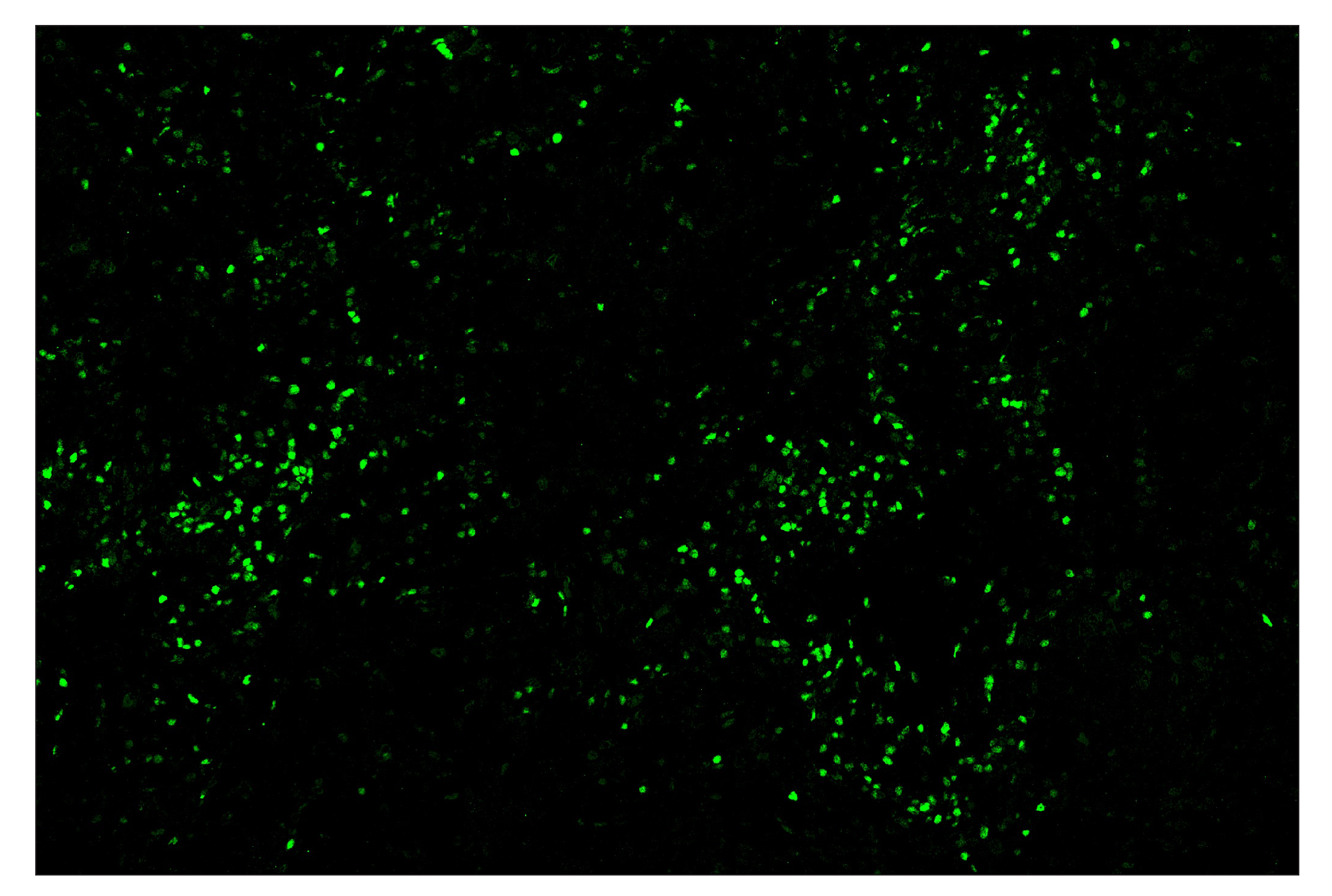 Immunohistochemistry Image 2: TCF1/TCF7 (C63D9) & CO-0006-647 SignalStar™ Oligo-Antibody Pair