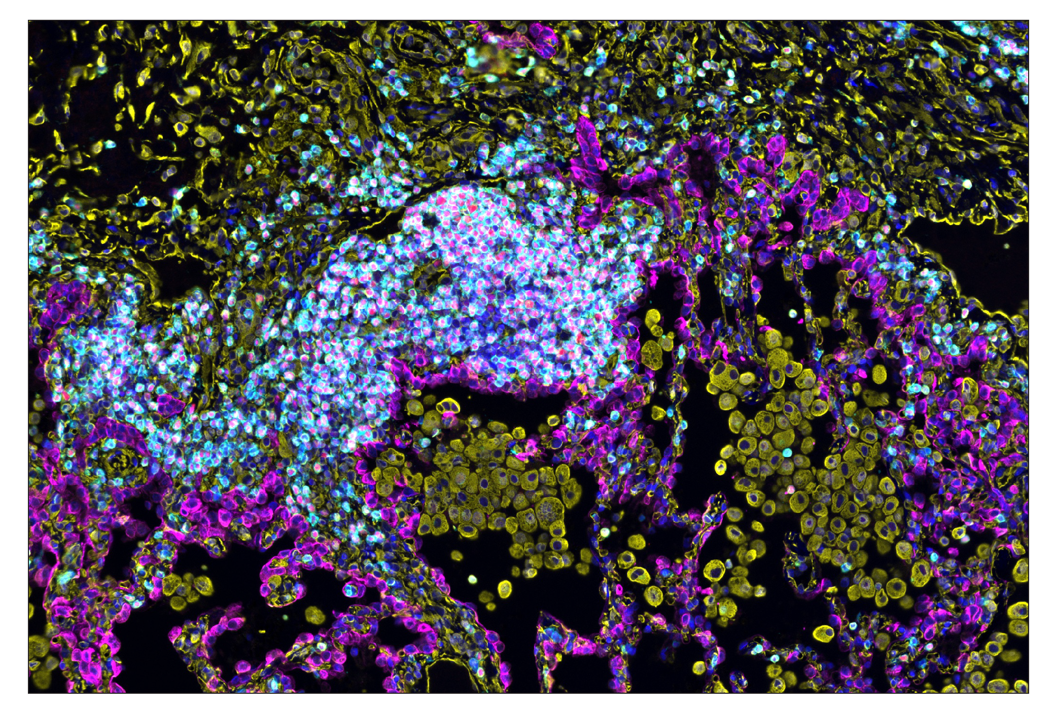 Immunohistochemistry Image 1: TCF1/TCF7 (C63D9) & CO-0006-750 SignalStar™ Oligo-Antibody Pair