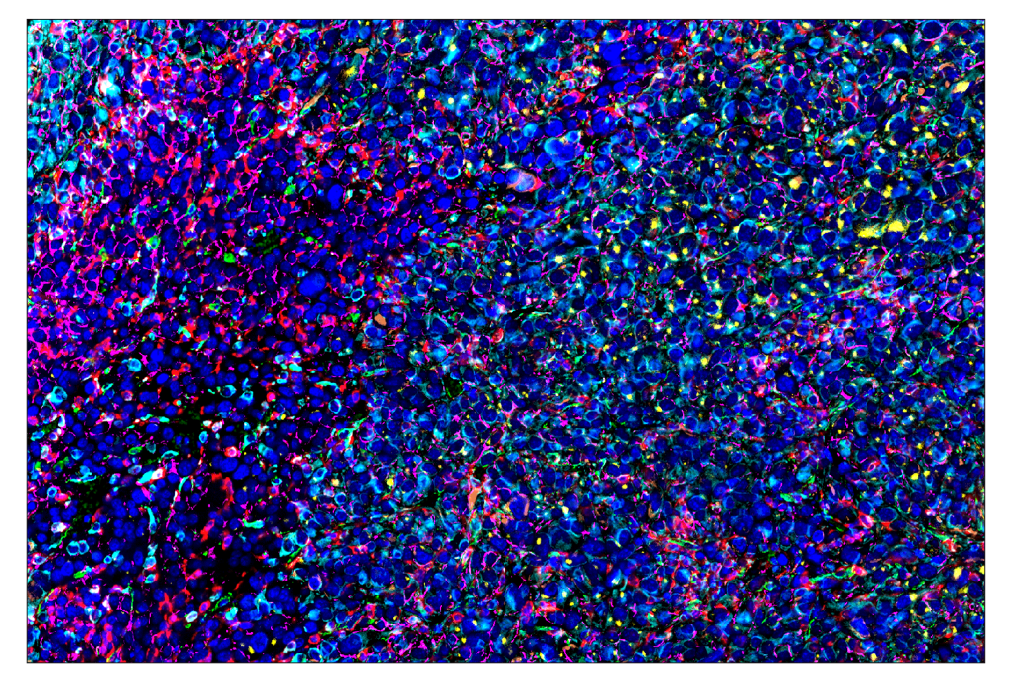 Immunohistochemistry Image 8: TCF1/TCF7 (C63D9) & CO-0006-488 SignalStar™ Oligo-Antibody Pair