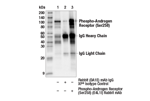 Immunoprecipitation Image 1: Phospho-Androgen Receptor (Ser258) (E4L1I) Rabbit mAb