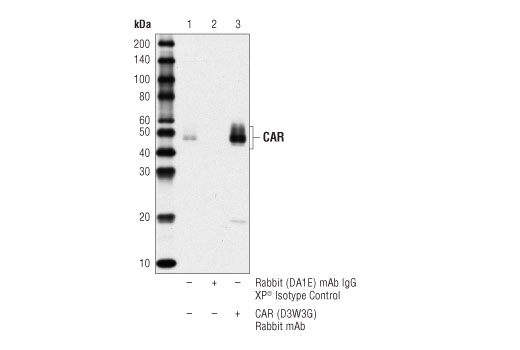 Immunoprecipitation Image 1: CAR (D3W3G) Rabbit mAb
