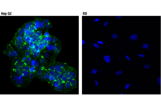 Immunofluorescence Image 1: CAR (D3W3G) Rabbit mAb