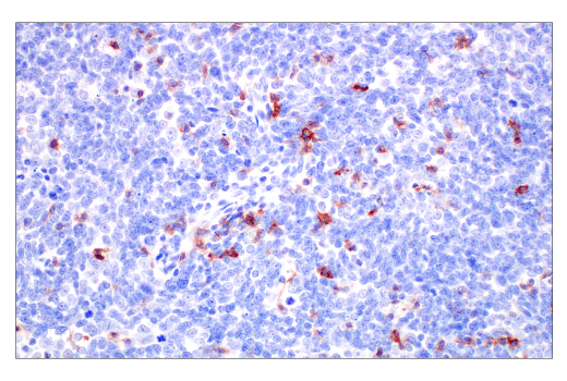 Immunohistochemistry Image 7: TIGIT (E5Y1W) XP® Rabbit mAb (BSA and Azide Free)
