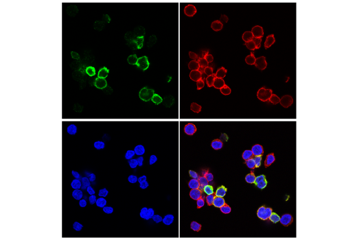 Immunofluorescence Image 2: TIGIT (E5Y1W) XP® Rabbit mAb (BSA and Azide Free)