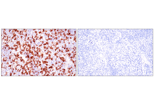 Immunohistochemistry Image 8: TIGIT (E5Y1W) XP® Rabbit mAb (BSA and Azide Free)