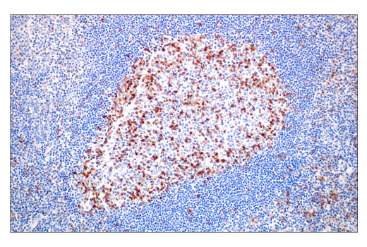 Immunohistochemistry Image 2: TIGIT (E5Y1W) XP® Rabbit mAb (BSA and Azide Free)