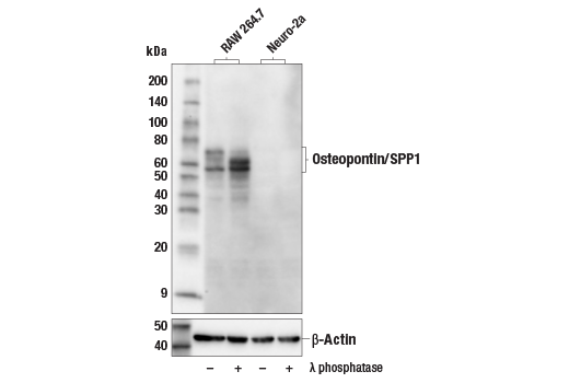 Western Blotting Image 1: Osteopontin/SPP1 (E9Z1D) Rabbit mAb (BSA and Azide Free)