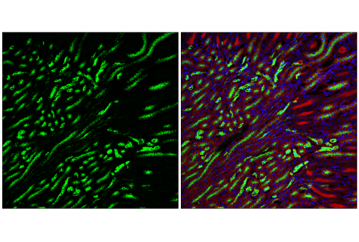 Immunofluorescence Image 2: Osteopontin/SPP1 (E9Z1D) Rabbit mAb (BSA and Azide Free)
