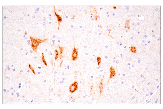 Immunohistochemistry Image 3: Osteopontin/SPP1 (E9Z1D) Rabbit mAb (BSA and Azide Free)