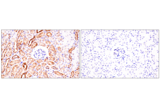 Immunohistochemistry Image 5: Osteopontin/SPP1 (E9Z1D) Rabbit mAb (BSA and Azide Free)