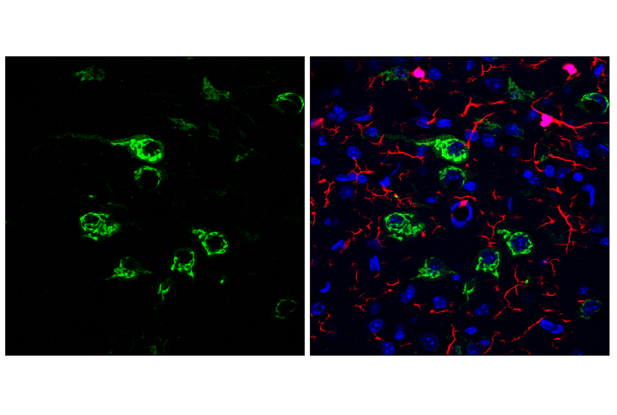 Immunofluorescence Image 1: Osteopontin/SPP1 (E9Z1D) Rabbit mAb (BSA and Azide Free)