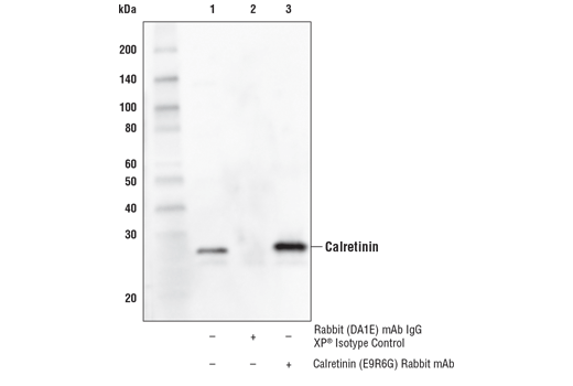 Immunoprecipitation Image 1: Calretinin (E9R6G) Rabbit mAb