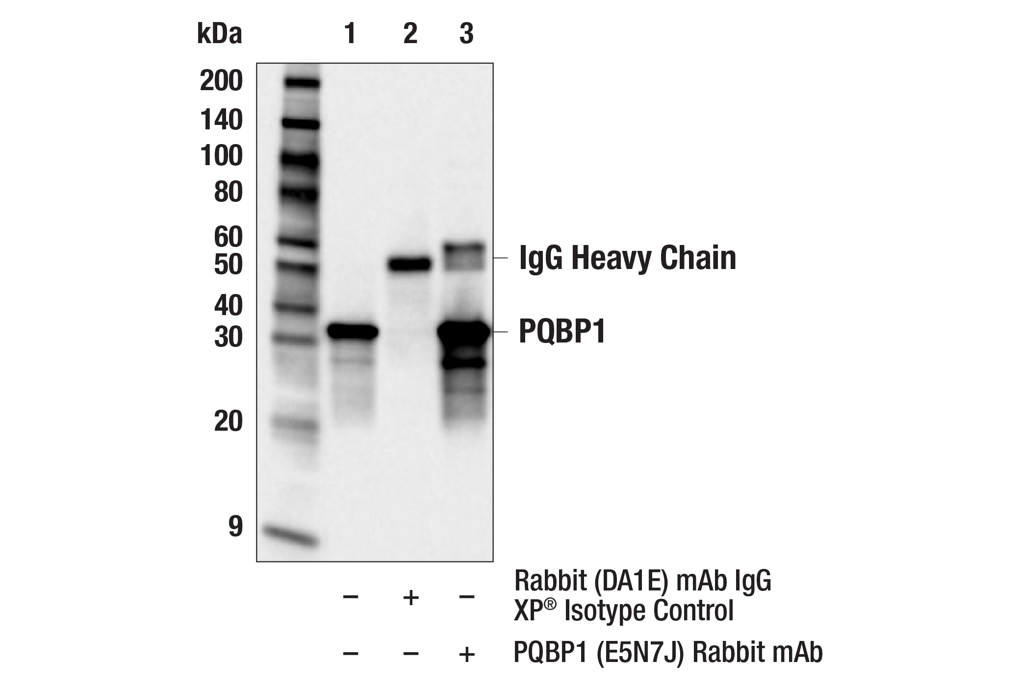 Immunoprecipitation Image 1: PQBP1 (E5N7J) Rabbit mAb
