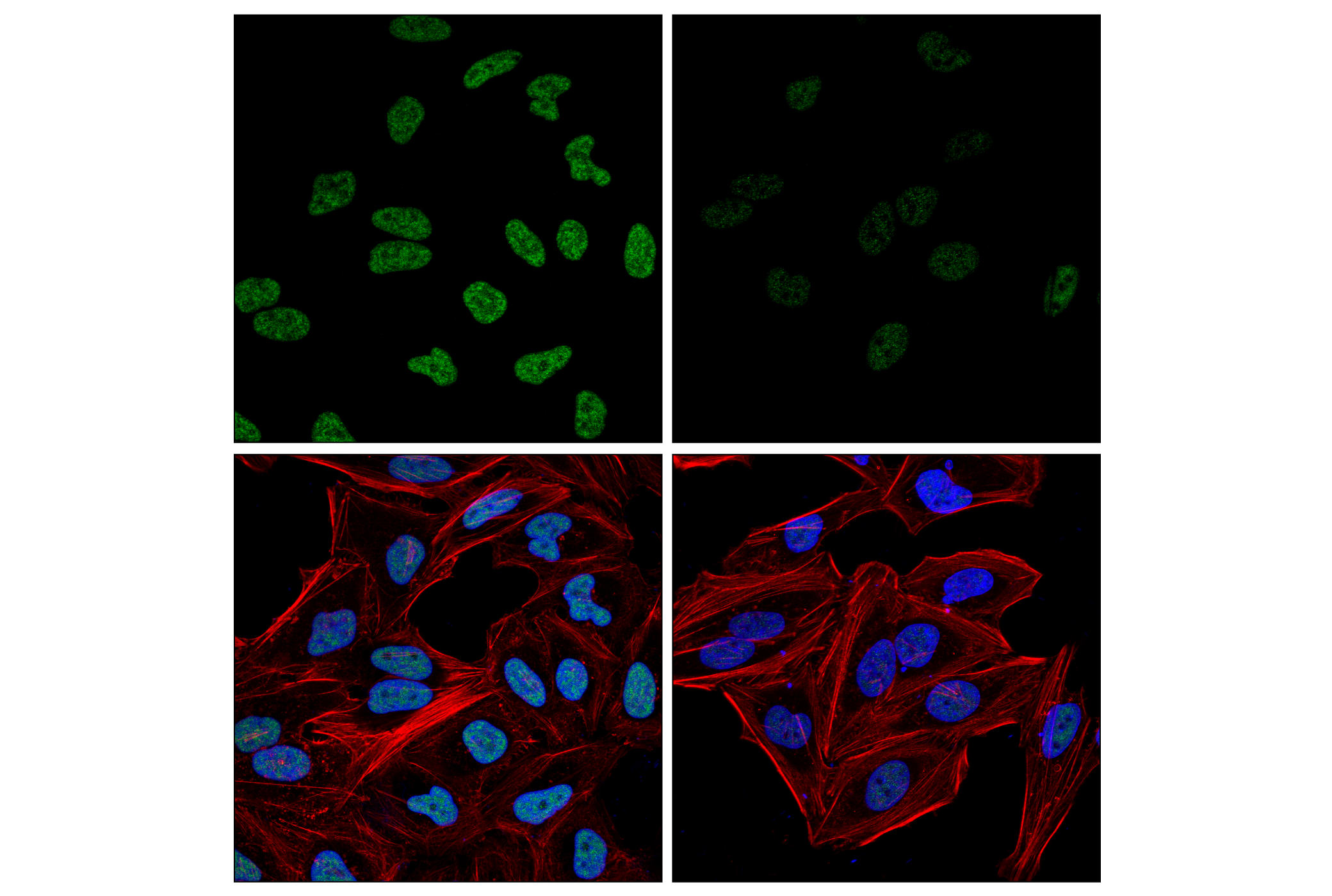 Immunofluorescence Image 1: PQBP1 (E5N7J) Rabbit mAb