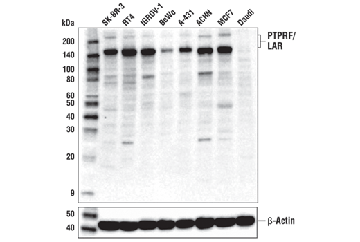 Western Blotting Image 1: PTPRF/LAR Antibody