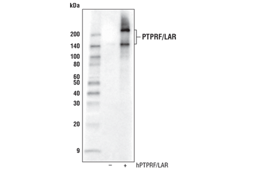 Western Blotting Image 2: PTPRF/LAR Antibody