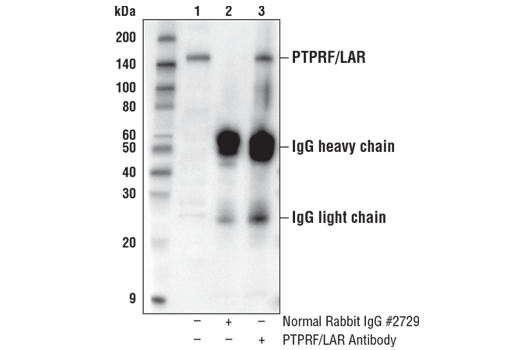 Immunoprecipitation Image 1: PTPRF/LAR Antibody