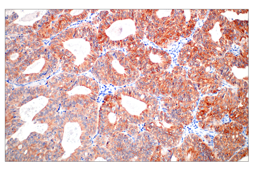 Immunohistochemistry Image 3: Pan-Keratin (C11) Mouse mAb (BSA and Azide Free)