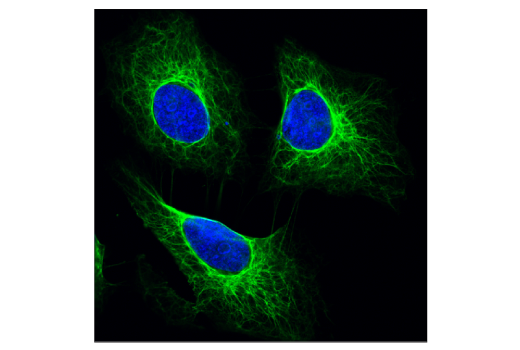 Immunofluorescence Image 1: Pan-Keratin (C11) Mouse mAb (BSA and Azide Free)