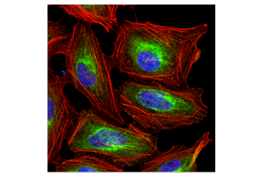Immunofluorescence Image 2: Pan-Keratin (C11) Mouse mAb (BSA and Azide Free)
