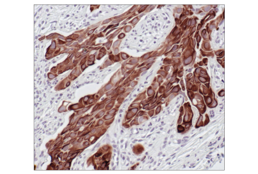 Immunohistochemistry Image 8: Pan-Keratin (C11) Mouse mAb (BSA and Azide Free)