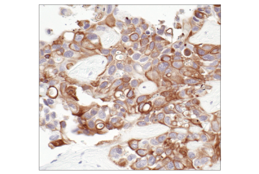 Immunohistochemistry Image 6: Pan-Keratin (C11) Mouse mAb (BSA and Azide Free)