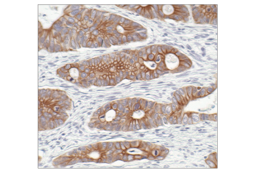 Immunohistochemistry Image 7: Pan-Keratin (C11) Mouse mAb (BSA and Azide Free)
