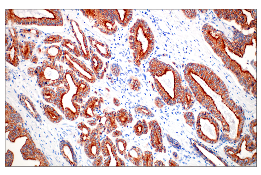 Immunohistochemistry Image 2: Pan-Keratin (C11) Mouse mAb (BSA and Azide Free)