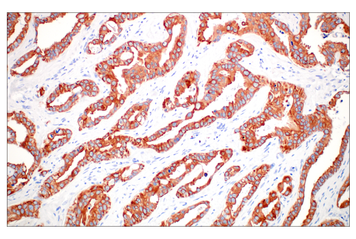 Immunohistochemistry Image 1: Pan-Keratin (C11) Mouse mAb (BSA and Azide Free)