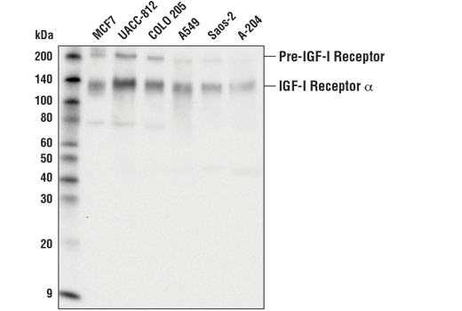 Western Blotting Image 1: IGF-I Receptor α (D3A2W) Rabbit mAb