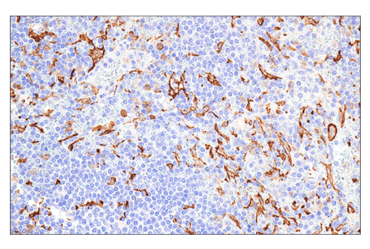  Image 26: Mouse Reactive M1 vs M2 Macrophage IHC Antibody Sampler Kit