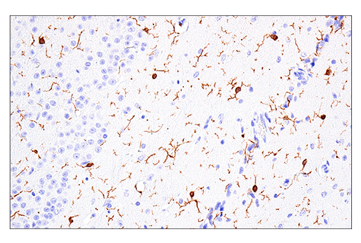  Image 41: Mouse Reactive Alzheimer's Disease Model Microglia Phenotyping IF Antibody Sampler Kit