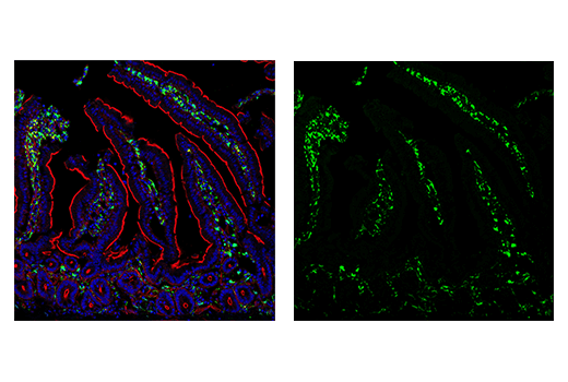 Immunofluorescence Image 2: Iba1/AIF-1 (E4O4W) XP® Rabbit mAb