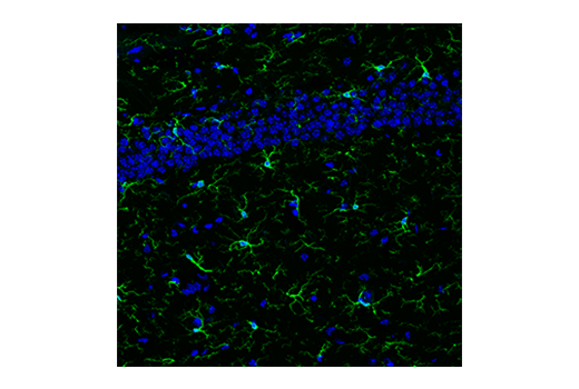 Immunofluorescence Image 4: Iba1/AIF-1 (E4O4W) XP® Rabbit mAb