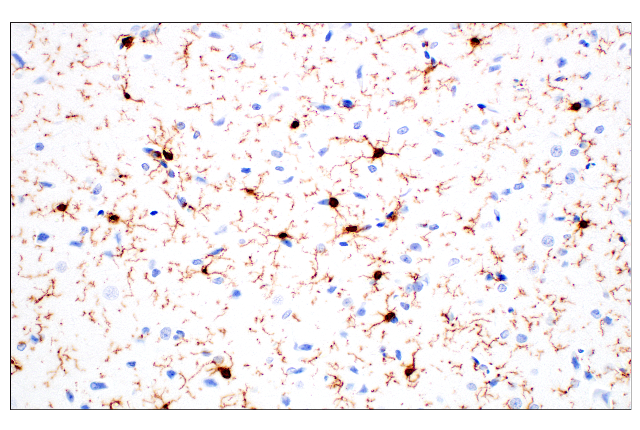 Image 58: Mouse Reactive Alzheimer's Disease Model Microglia Phenotyping IF Antibody Sampler Kit