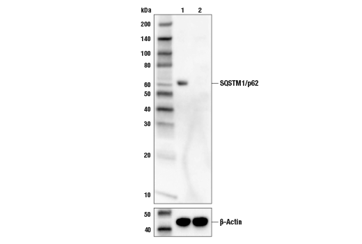Western Blotting Image 1: SQSTM1/p62 (D5L7G) Mouse mAb (BSA and Azide Free)
