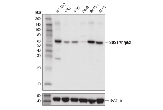 Western Blotting Image 2: SQSTM1/p62 (D5L7G) Mouse mAb (BSA and Azide Free)
