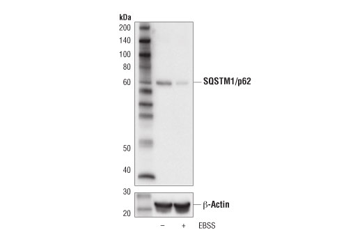 Western Blotting Image 3: SQSTM1/p62 (D5L7G) Mouse mAb (BSA and Azide Free)