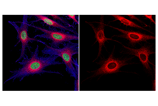 Immunofluorescence Image 1: Rab7 (D95F2) XP® Rabbit mAb (Alexa Fluor® 555 Conjugate)