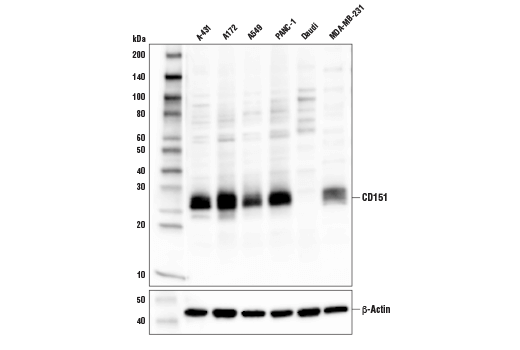 Western Blotting Image 2: CD151 Antibody
